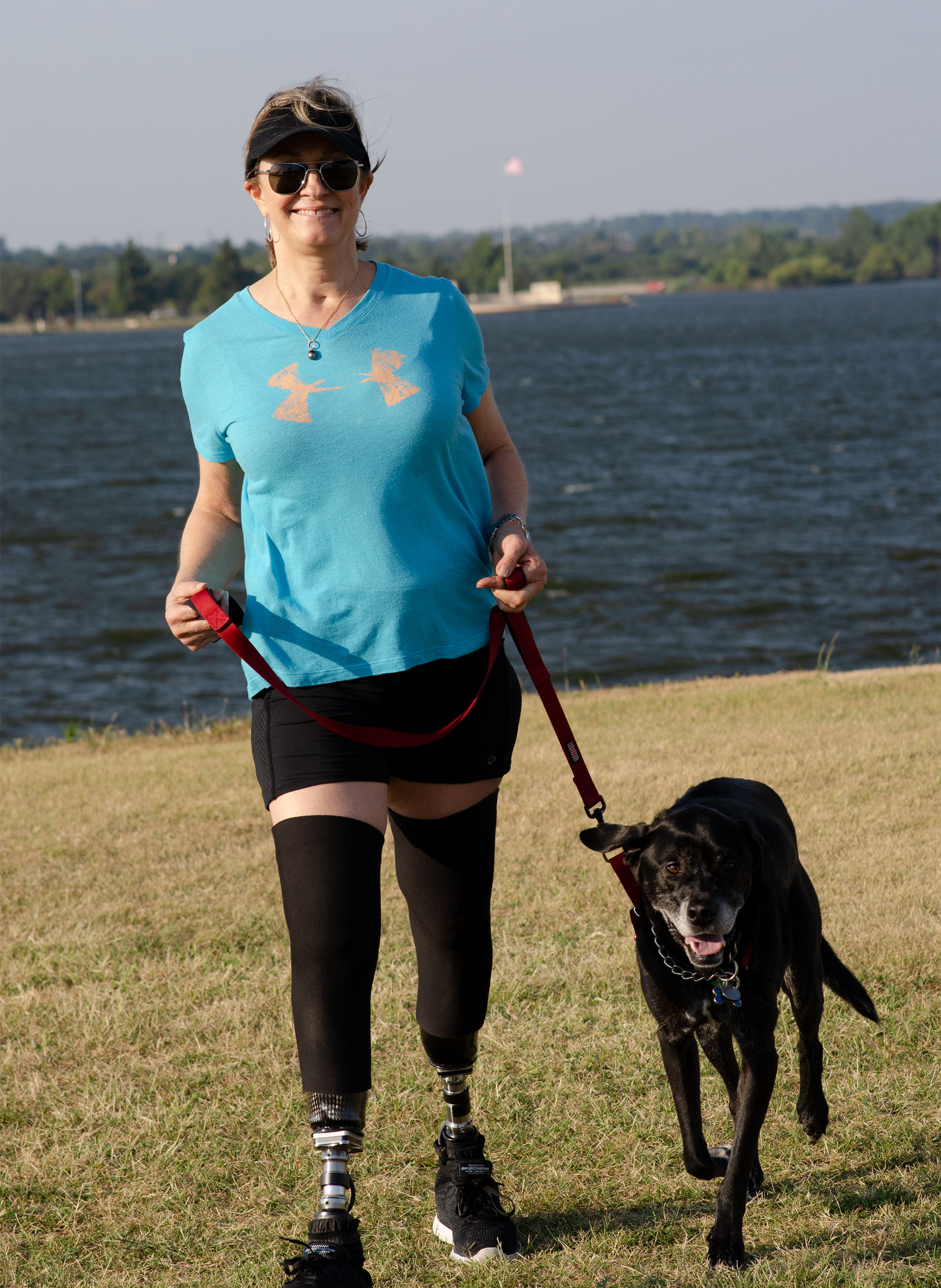 A woman who is a double amputee walk her dog at the lake.